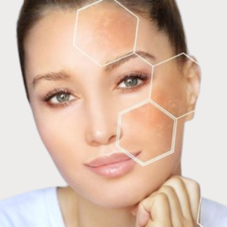 Manchas en el rostro Manchas en el rostro