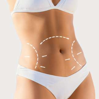 Reducción de medidas Reducción de medidas