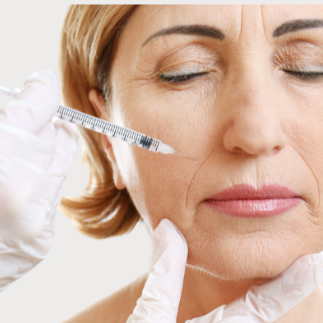 Eliminación de líneas de expresión Eliminación de líneas de expresión