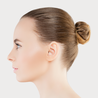 Rinomodelación Rinomodelación